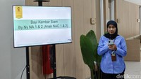 RSCM Sukses Pisahkan Bayi Kembar Siam Dempet Perut hingga Pinggul lewat Operasi 36 Jam