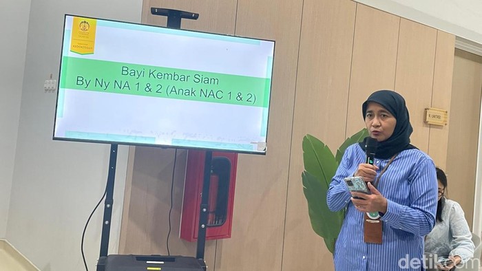 RSCM Sukses Pisahkan Kembar Siam Dempet Perut, Ini Tahapan Pemulihan Selanjutnya