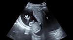 Yeay Selamat! Maudy Ayunda Hamil Anak Pertama
