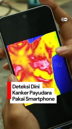 Video: Deteksi Dini Kanker Payudara Pakai Smartphone