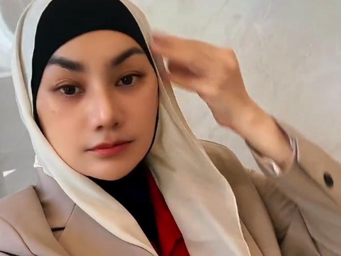 Sarita Abdul Mukti jalani operasi wajah dan hidung di Meko Hospital, Thailand, demi tampil lebih muda dan proporsional menjelang usianya yang ke-52 tahun.