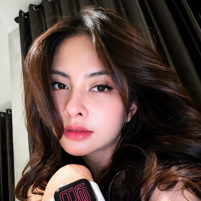 Potret 5 Artis Usai Operasi Makin Shining, Shimmering, Splendid!