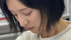 6 Potret Kim Ji Won di Tempat Kerja Saat Syuting Doctor X