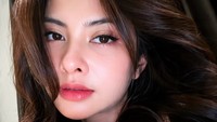 7 Potret Tiwi T2 Sebulan Usai Jalani Operasi Plastik, Makin Cantik & Fresh