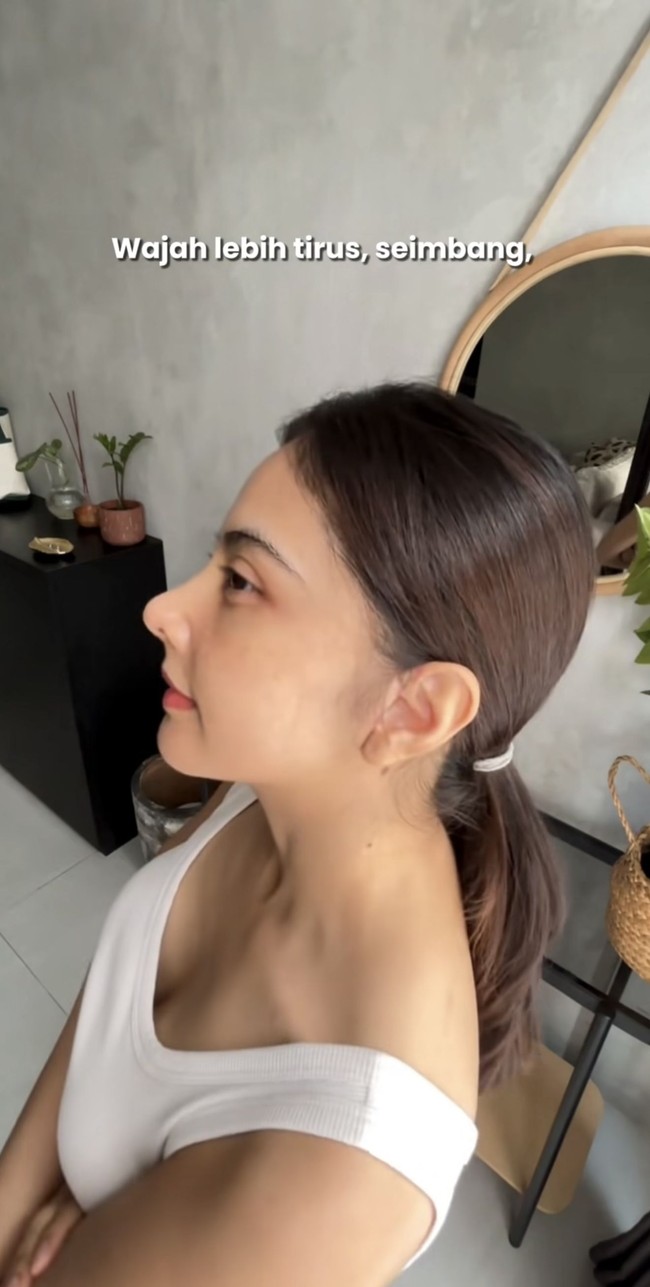 Dilihat dari samping, hidung Tiwi jelas terlihat jadi semakin mancung. Wajahnya pun tampak lebih tirus.&nbsp;Foto: Instagram/@tentangtiwi/@indonesia_banobagi