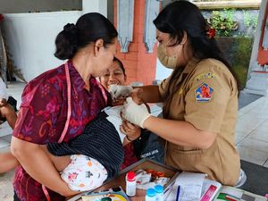 1.014 Balita di Buleleng Alami Stunting