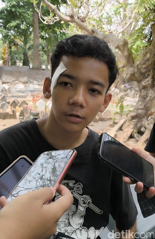 Fahmi Abdurrahman, korban selamat pembacokan yang dilakukan geng motor, saat diwawancarai, Rabu (28/10/2026). Dok. Nathea Citra/detikBali