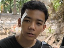 Kesaksian Fahmi Selamat dari Pembacokan di Jalan Udayana: Saya Pasrah