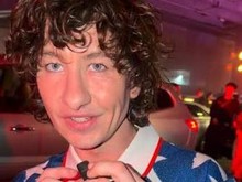 Dihujat Berwajah Aneh, Barry Keoghan Lakukan Treatment Kecantikan