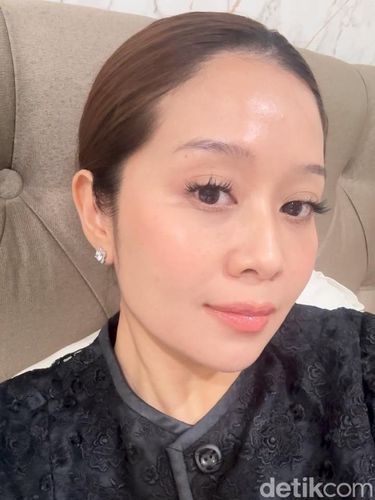 Mencoba Treatment Exosome, Ini Hasil Setelah 2 Minggu