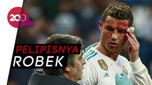 Momen Ronaldo Bersimbah Darah Saat Mencetak Gol