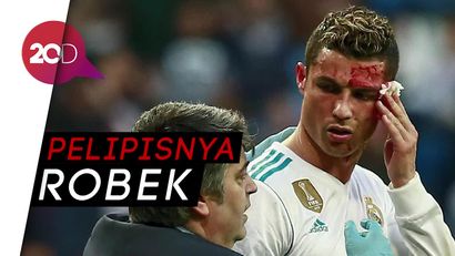Momen Ronaldo Bersimbah Darah Saat Mencetak Gol