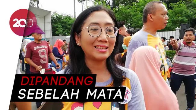 Minimnya Lapangan Pekerjaan untuk 'Down Syndrome'