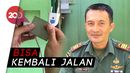 Manfaat Terapi Kejut Listrik bagi Penderita Stroke Manfaat Terapi Kejut Listrik bagi Penderita Stroke