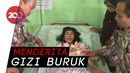 Kasihan, Gadis di Mojokerto Hampir Tersisa Tulang dan Kulit Kasihan, Gadis di Mojokerto Hampir Tersisa Tulang dan Kulit