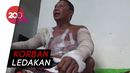 Waduh! Tubuh Pria Ini Terbakar Usai Bakar Sampah Waduh! Tubuh Pria Ini Terbakar Usai Bakar Sampah