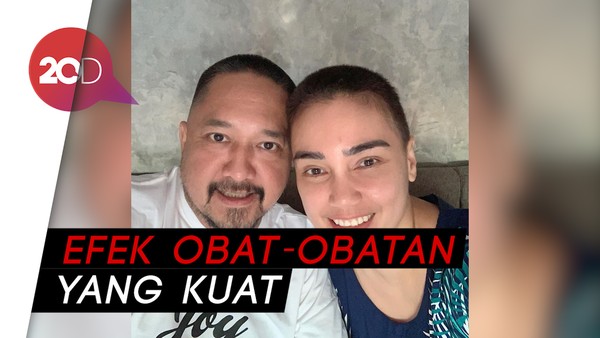 Seperti Feby Febiola, Ini Penyebab Rambut Rontok saat Kemoterapi