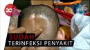 Karena Kanker Otak, Sebagian Tempurung Kepala Istri Reza Dibuang Karena Kanker Otak, Sebagian Tempurung Kepala Istri Reza Dibuang
