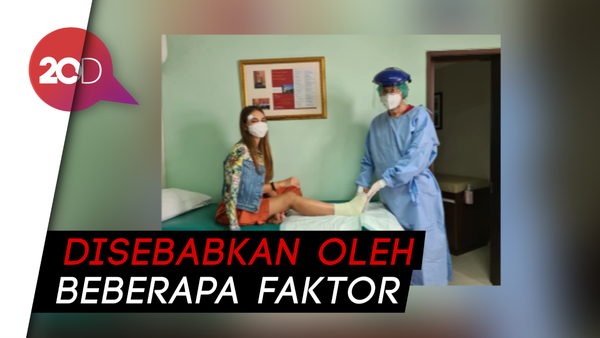 Mengenal Metatarsal, Cedera Patah Tulang yang Dialami Luna Maya