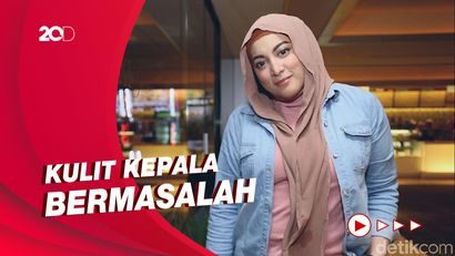 Heboh Foto Tanpa Hijab, Jane Shalimar Buka Suara