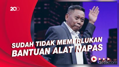 Kondisi Terkini Tukul: Masih di ICU Tapi Ventilator Sudah Copot