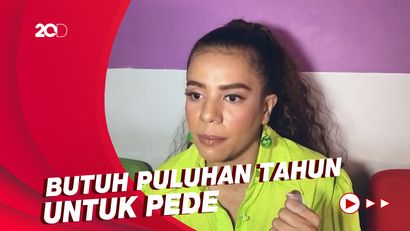 Cerita Nowela Sering Di-bully soal Kulit dan Rambutnya saat Kecil