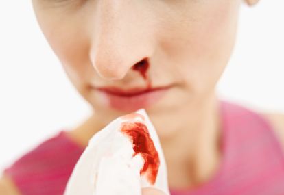 Berdarah sebelah kiri kenapa hidung Hidung Berdarah