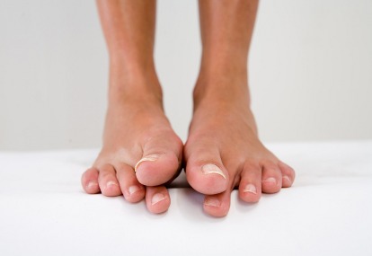 Telapak kaki berkeringat tanda penyakit apa