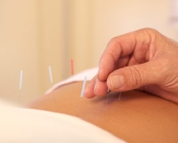 akupunktur slimming jakarta barat
