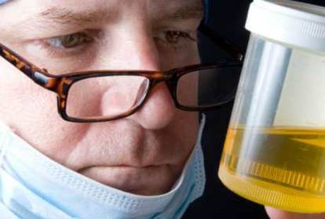Ini Ciri Urine Orang yang Ginjalnya Bermasalah Ini Ciri Urine Orang yang Ginjalnya Bermasalah