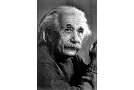 Analisa Otak Peneliti Ungkap Mengapa Albert Einstein Jenius