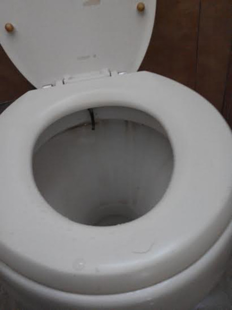 Bulu Kemaluan pun Nangkring di Dudukan Toilet