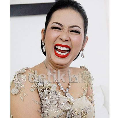 5 Selebriti Indonesia dengan Gigi Putih dan Rapi karena Dilapisi Veneer 5 5 Selebriti Indonesia dengan Gigi Putih dan Rapi karena Dilapisi Veneer 5