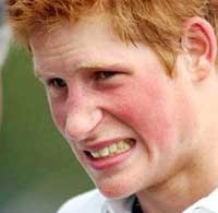 Pangeran Harry... Tabrak Lari!