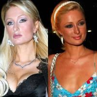 Payudara Membesar, Paris Hilton Dicibir