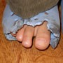 Kisah Lain tentang Insiden Crocs