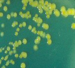 Enterobacter Sakazaki Siapa Takut?