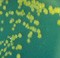 Enterobacter Sakazaki Siapa Takut?
