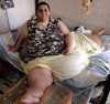 Pria Tergemuk di Dunia Berhasil Susut 254 Kilogram