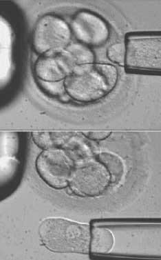 Kabinet Belanda Bolehkan Seleksi Embrio Manusia