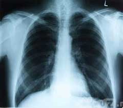 Merokok Bukan Polusi Udara