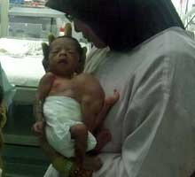 Kondisi Stabil, Yovansa akan Dipindah ke Irna Anak