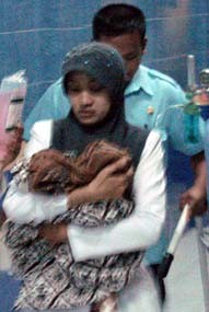 Kembar Siam Dempet Dada Lahir di Pacitan