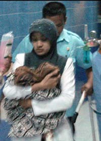 Penyebab Kembar Siam Meninggal karena Kekurangan Oksigen 
