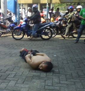 Suami Mengamuk, Perut Istri Disayat Hingga Usus Terburai