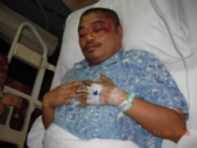 Belum Pulih, Romo Benny Belum Lapor Polisi
