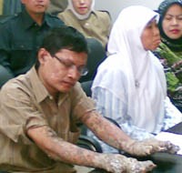 Dede Manusia Pohon Kangen Rumah