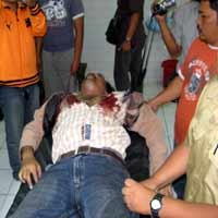 Dada Dua Spesialis Ranjau Paku Diterjang Peluru