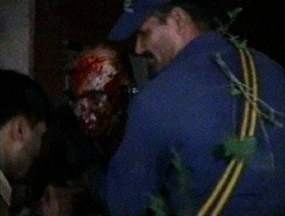 Bom Bunuh Diri Penyebab Ledakan Hotel Marriot Pakistan