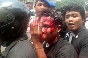 Mabes Polri Bantah Kecolongan Bentrokan FPI dan AKKBB